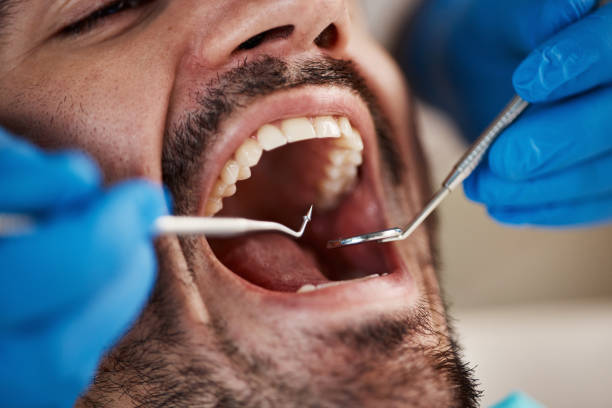 Professional Emergency Dentist in IL