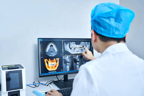 Best Emergency Wisdom Teeth Removal in Lyons, IL